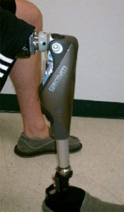 Prosthetic Devices in San Diego | ABI P&O